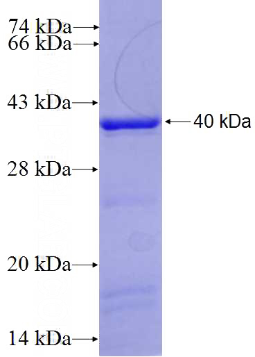 Recombinant Human KCTD12 SDS-PAGE