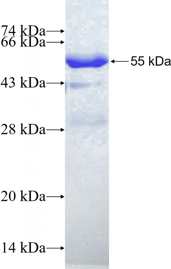 Recombinant Human EXOSC5 SDS-PAGE