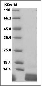 Human CXCL1 / MGSA / NAP-3 Protein SDS-PAGE