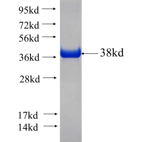 Recombinant human PIP5K1B SDS-PAGE