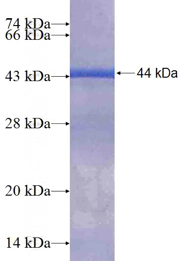 Recombinant Human NARS2 SDS-PAGE