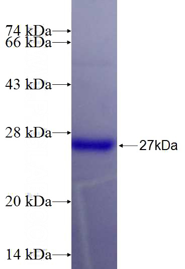 Recombinant Human MAP6 SDS-PAGE