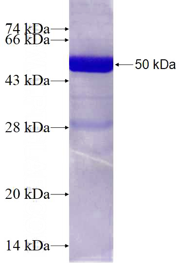 Recombinant Human RAB4A SDS-PAGE