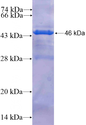 Recombinant Human MRPS25 SDS-PAGE