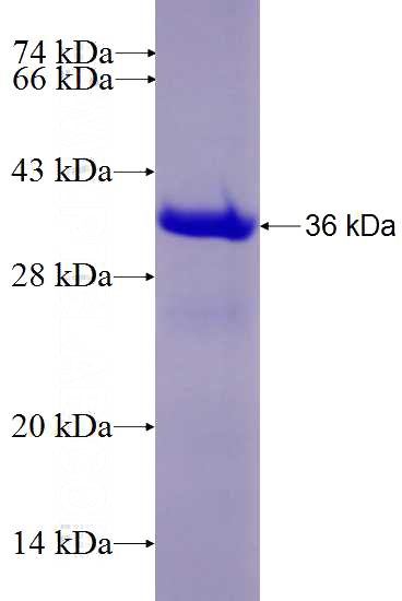 Recombinant Human HLA class I (HLA-A) SDS-PAGE