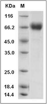 Human CD68 / Macrosialin / Gp110 Protein (aa 1-319, His Tag) SDS-PAGE