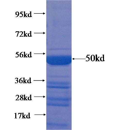 Human IL1F7 Recombinant protein (GST)