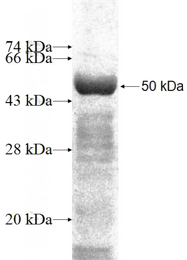 Recombinant Human PSMC6 SDS-PAGE