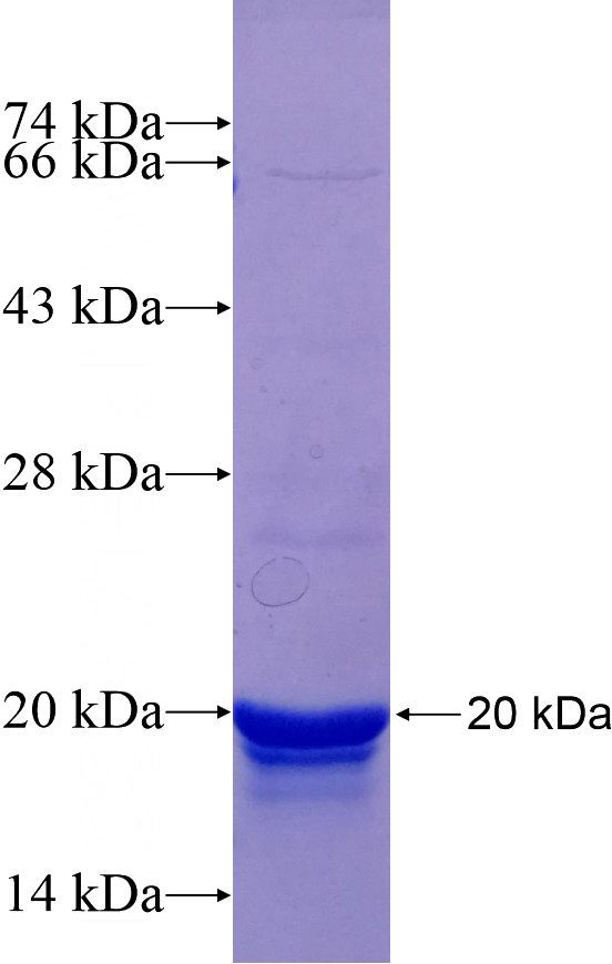 Recombinant Human DNAJB3 SDS-PAGE