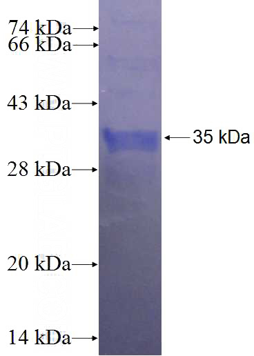 Recombinant Human CPO SDS-PAGE