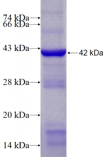 Recombinant Human LGR6 SDS-PAGE