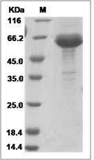 Human IL-23 (IL12B & IL23A Heterodimer) Protein (His Tag)