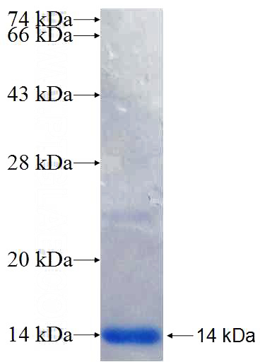 Recombinant Human JAK1 SDS-PAGE