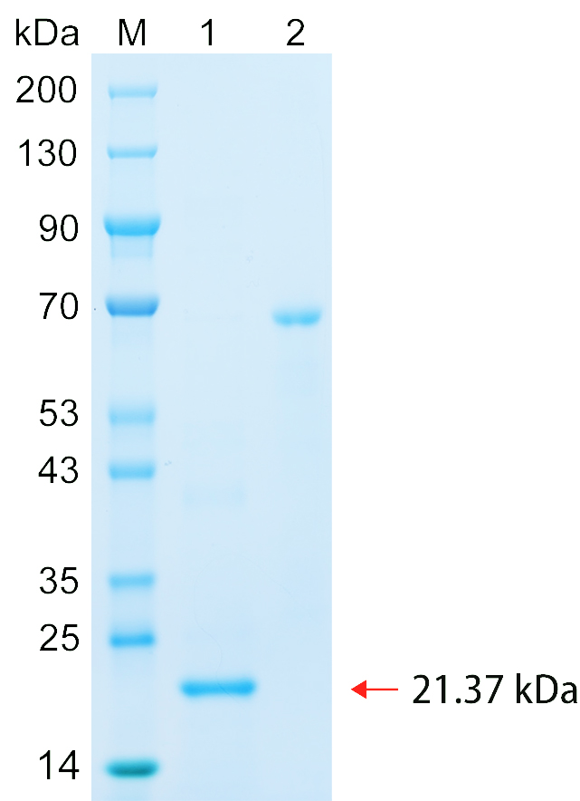 Recombinant FBX16 protein (His tag) SDS-PAGE