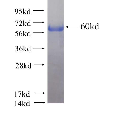 Recombinant human ARPC2(Full length) SDS-PAGE
