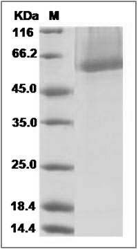 Mouse MMP8 / CLG1 Protein (His Tag) SDS-PAGE