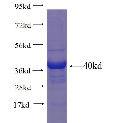 Recombinant human SPATS1 SDS-PAGE