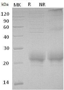 Human CD160/BY55 (His tag) recombinant protein