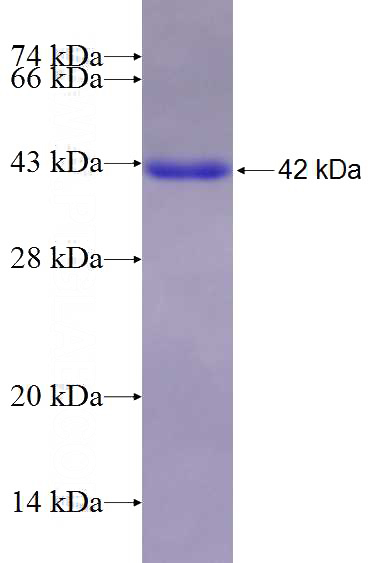 Recombinant Human PPP2CA SDS-PAGE