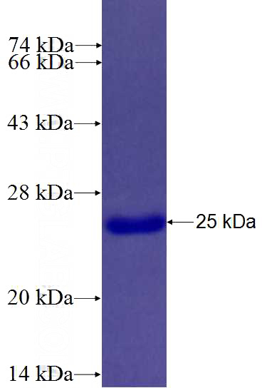 Recombinant Human RRAD SDS-PAGE
