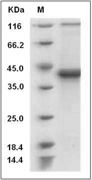 Mouse S100B / S100beta Protein (Fc Tag) SDS-PAGE