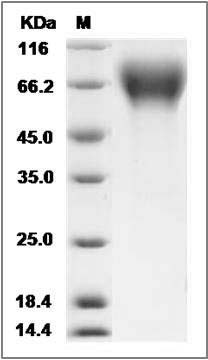 Rat CD6 / TP120 Protein (His Tag) SDS-PAGE
