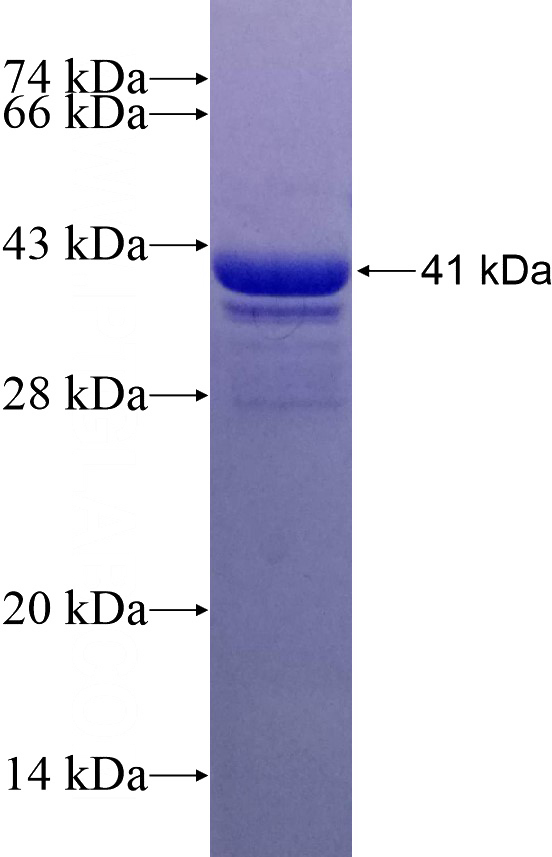 Recombinant Human MYL5 SDS-PAGE