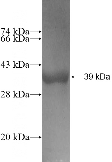 Recombinant Human B3GALNT2 SDS-PAGE