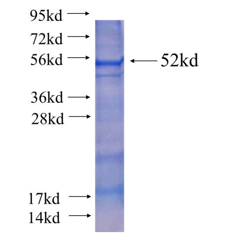 Recombinant human MNDA(Full length) SDS-PAGE