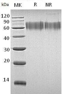 Human LYPD3/C4.4A/UNQ491/PRO1007 (His tag) recombinant protein