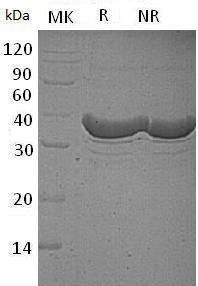 Human GALE (His tag) recombinant protein