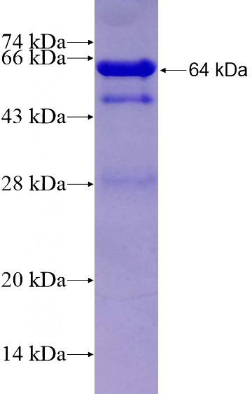Recombinant Human SPATA1 SDS-PAGE