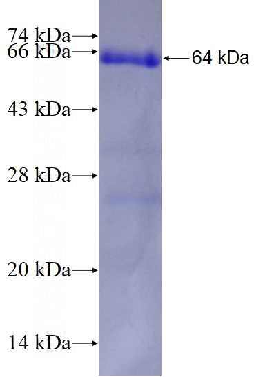 Recombinant Human SYT3 SDS-PAGE