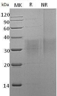 Human BMPR2/PPH1 (His tag) recombinant protein