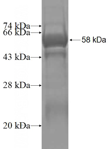 Recombinant Human E2F6 SDS-PAGE