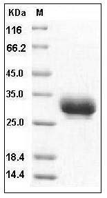 Human CD32a / FCGR2A Protein (167 Arg, His Tag) SDS-PAGE