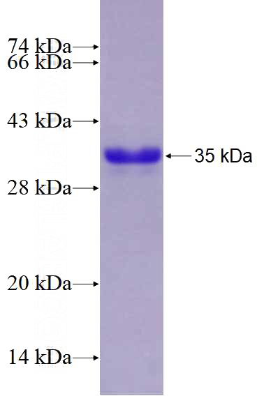 Recombinant Human CXorf67 SDS-PAGE