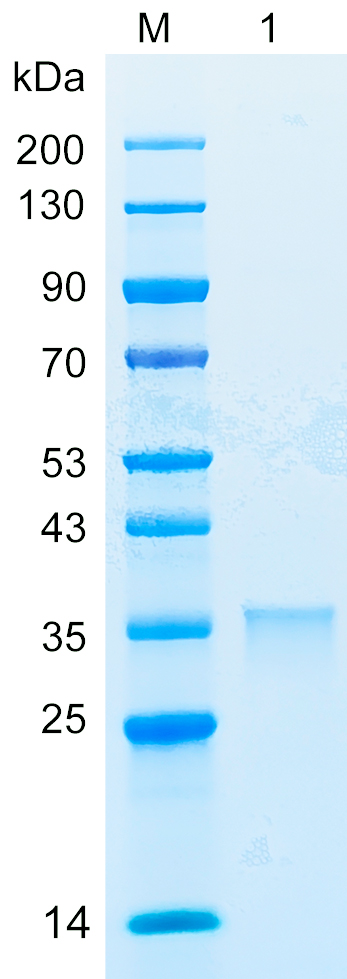 Recombinant CCNE2 protein (His tag) SDS-PAGE