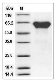 Mouse ACVR2A / ActrIIa Protein (His & Fc Tag) SDS-PAGE