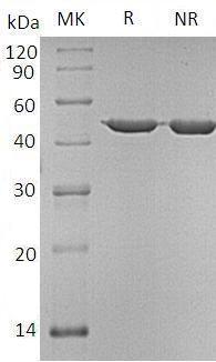 Human ANXA7/ANX7/SNX/OK/SW-cl.95 recombinant protein