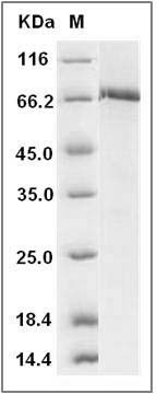 Human c-MET / HGFR Protein (aa 956-1390, His & GST Tag) SDS-PAGE