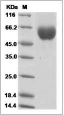 Rat Apolipoprotein H / APOH Protein (His Tag)