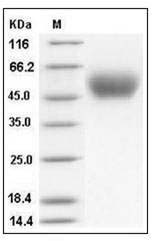 Mouse PLAUR / CD87 / uPAR Protein (His Tag) SDS-PAGE
