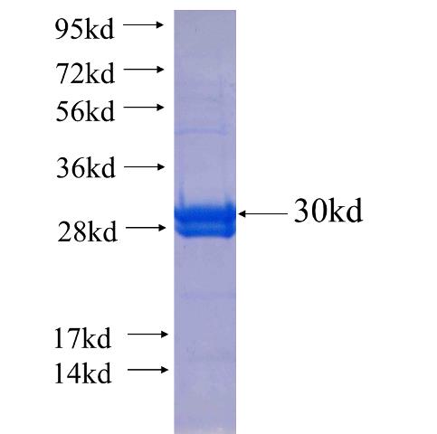 Recombinant human NEUROD2 SDS-PAGE