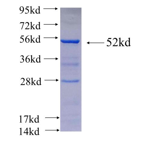 Recombinant human EPB49(Full length) SDS-PAGE