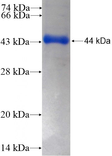 Recombinant Human SGSM3 SDS-PAGE