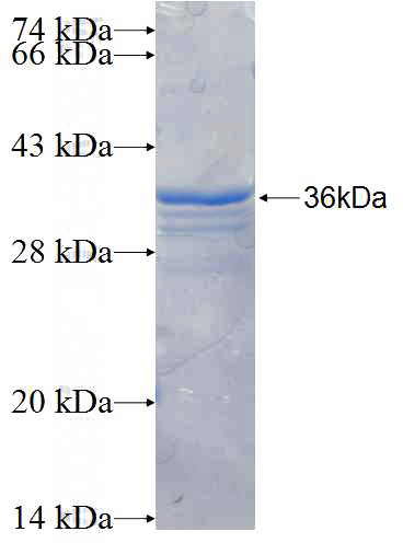 Recombinant Human RANBP2 SDS-PAGE