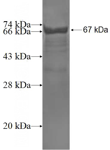 Recombinant Human ASCC1 SDS-PAGE