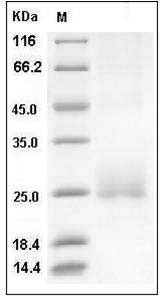 Human CD160 Protein (His Tag) SDS-PAGE