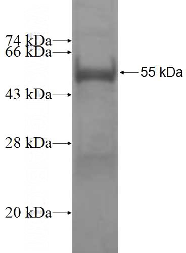 Recombinant Human PYCRL SDS-PAGE